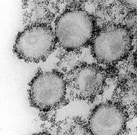 HIVirus v elektronovm mikroskopu